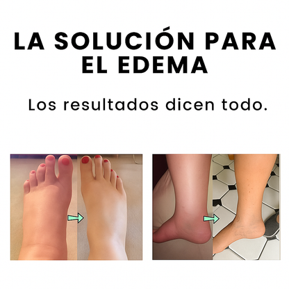 Bálsamo MillowSupply™ | Elimina el edema en pocos días