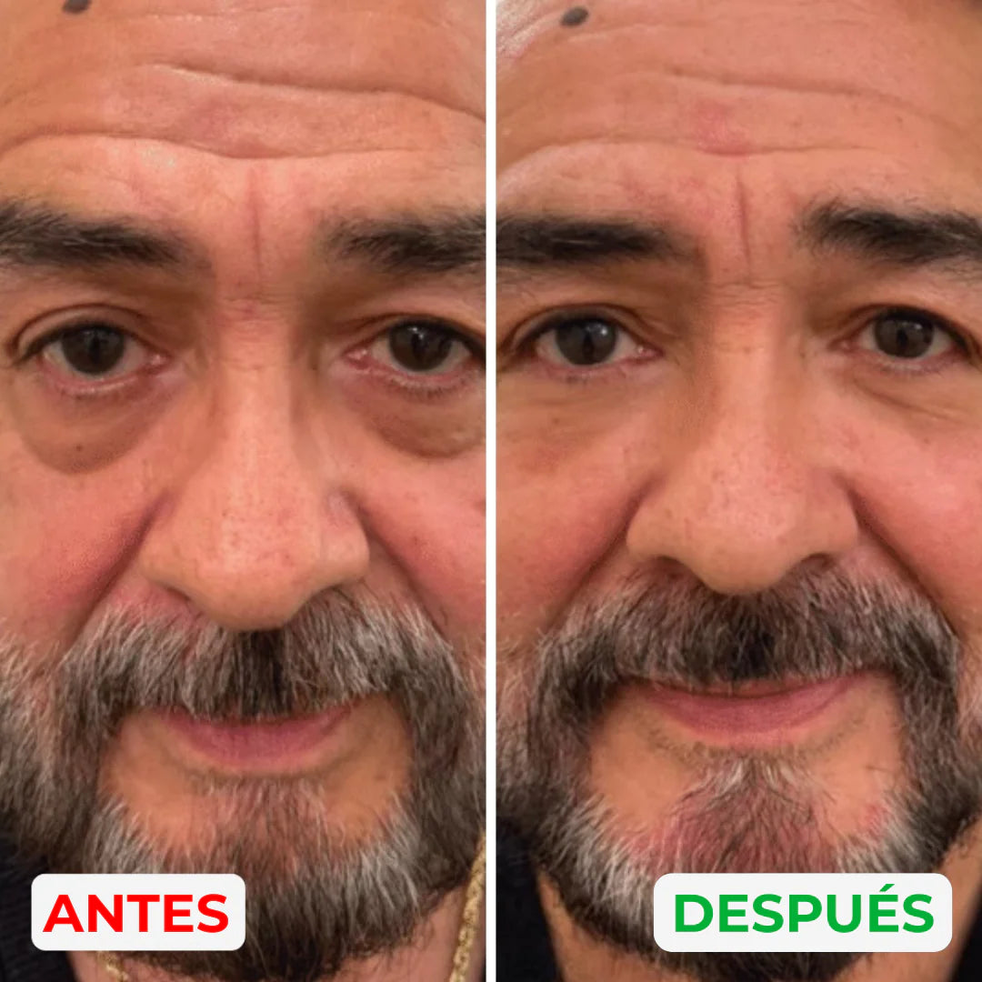 MillowSupply™ Reparador de ojeras