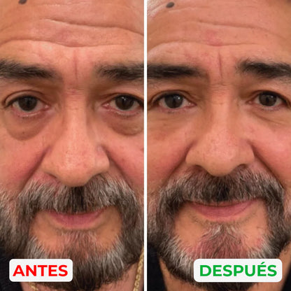 MillowSupply™ Reparador de ojeras
