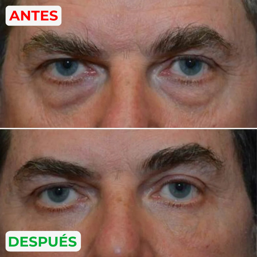 MillowSupply™ Reparador de ojeras