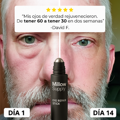 MillowSupply™ Reparador de ojeras